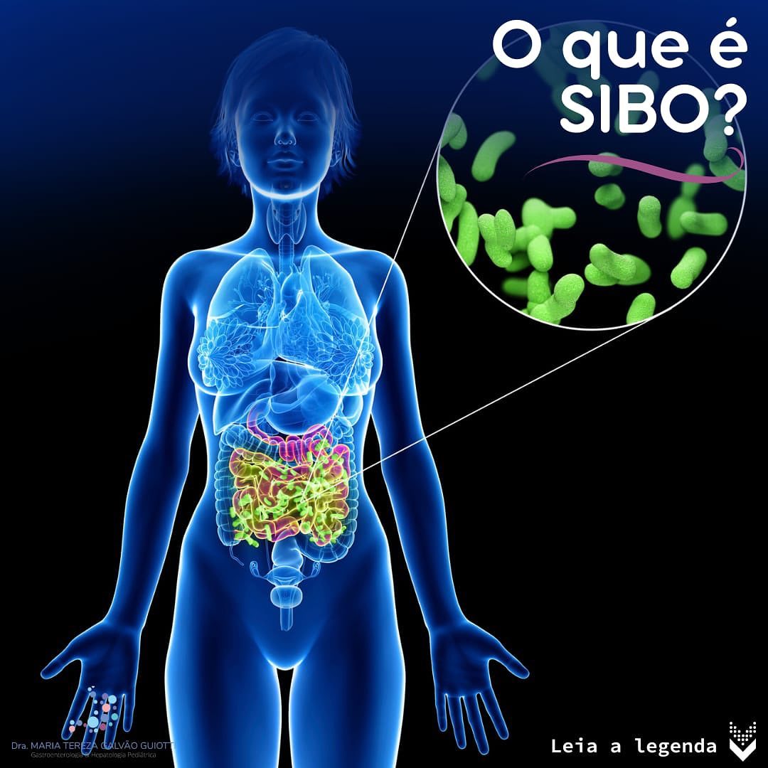 O que e SIBO pop pediatria dra maria tereza gastropediatria gastro hepato pediatria pinheiros sao paulo gastrointestinal germes microorganismos intestino gelado sintomas